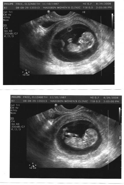 Our Little Addition